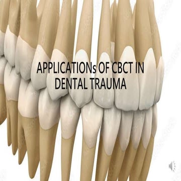 Cracked tooth syndrom | PPTX