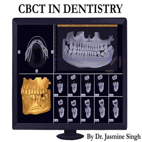 CBCT in Dentistry