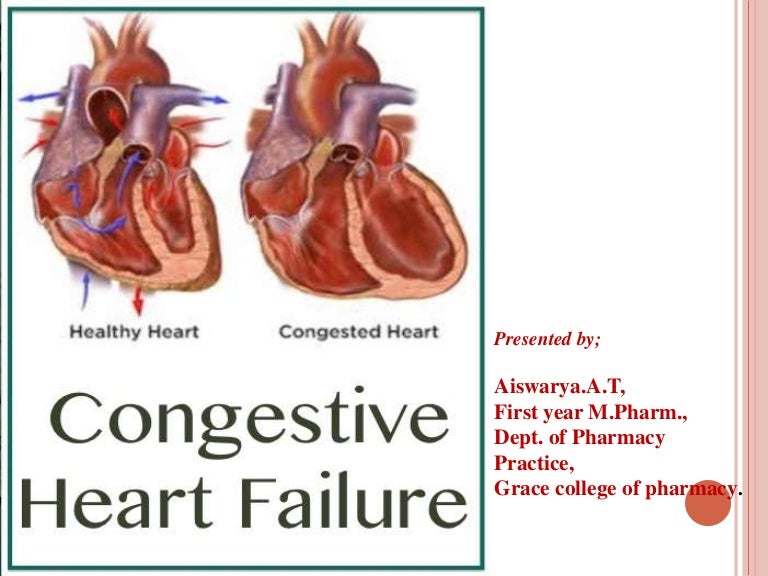 Congestive Cardiac Failure