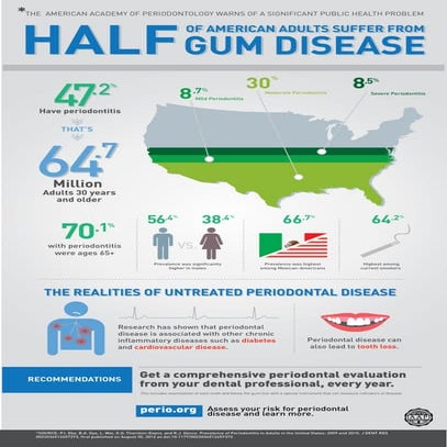 Prevalence of Periodontal Disease | PDF