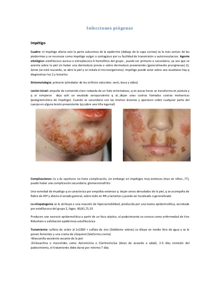 golondrino axila in english