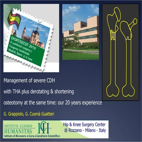 Displasia congenita anca - EFORT Madrid 2010