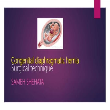 Congenital Diaphragmatic Hernia ; Summary and updates