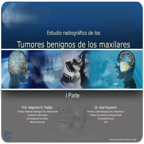 ESTUDIO RADIOGRÁFICO DE LOS TUMORES BENIGNOS ODONTOGÉNICOS (Parte I)
