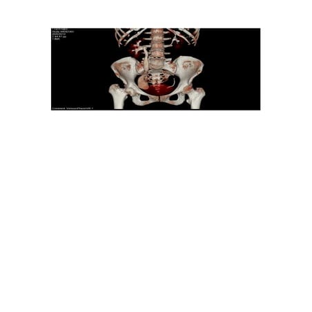 μεγαουρητήρας