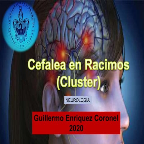 Cefalea en racimos 2020 | PPTX