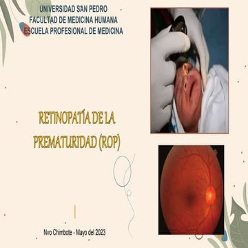 Retinopatia de la prematuridad (ROP) | PPTX