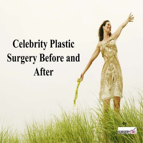 Celebrity plastic surgery before and after