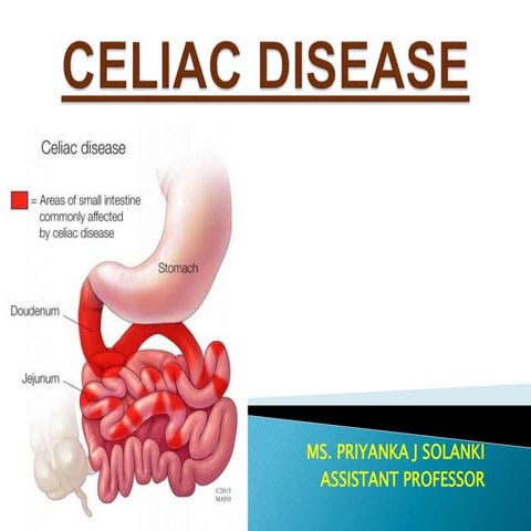 Celiac disease
