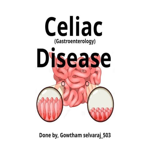 Celiac Disease_Gastroenterology (Gowtham_503) (1).pptx