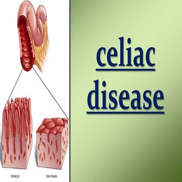Celiac disease 