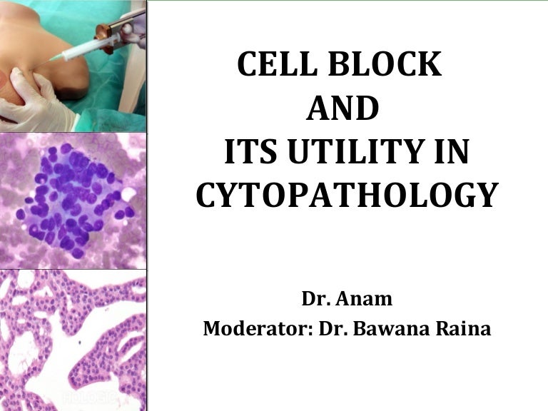 Cell block in cytology