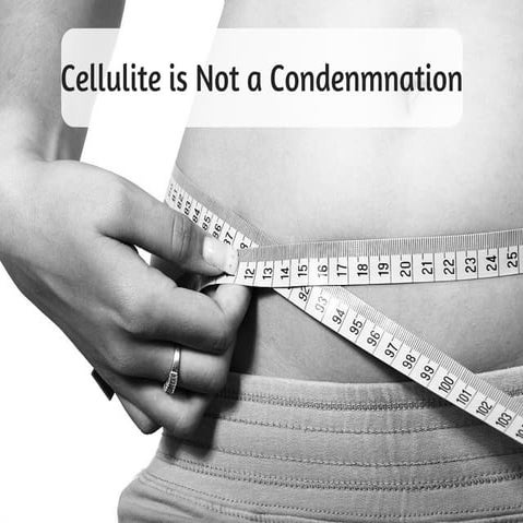 What Causes Cellulite? | PDF