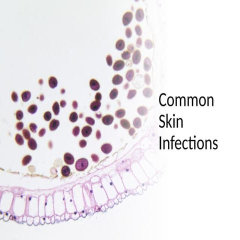 Skin Infections.pptx
