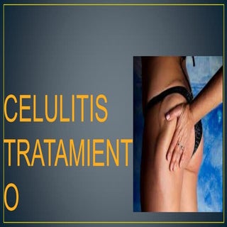 Celulitis tratamiento