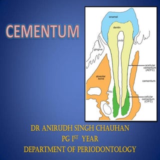 Cementum