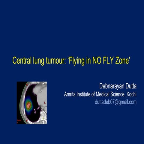 Central Lung Tumour: 'Flying in NO Flying Zone'