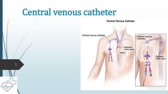 PPT - central line(Central Venous Catheters) | PPT