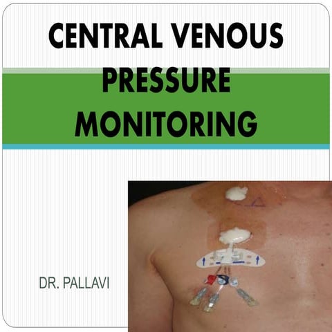 Central venous pressure monitoring 