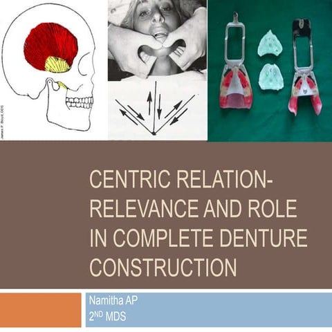 Centric relation relevance and role in complete denture construction 