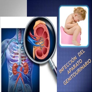 infección del tracto urinario (ITU)