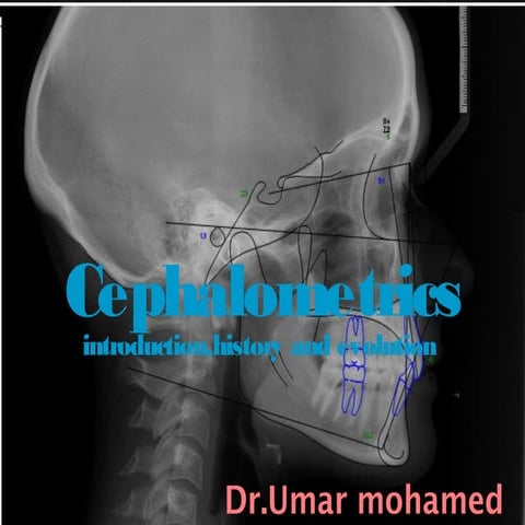 Cephlometric history, evolution & landmarks