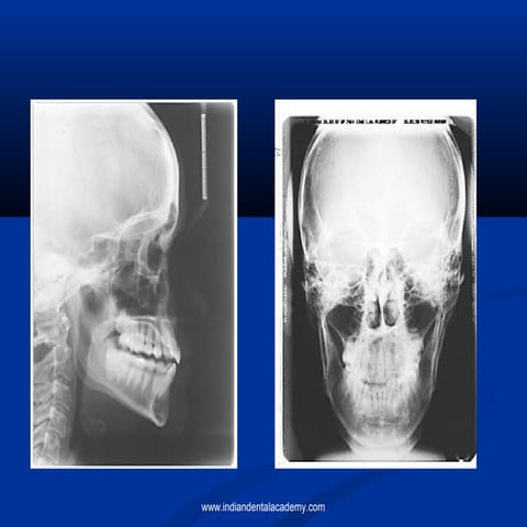 Cephalometry in orthodontics