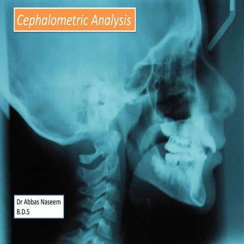 Cephalometric analysis