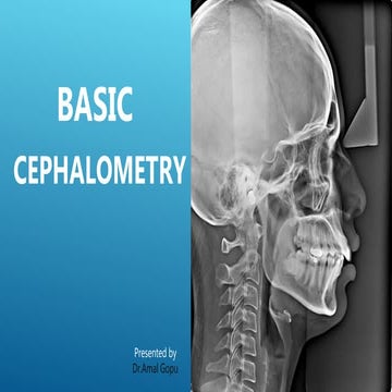 ceph part -Dr Amal Gopu.pptx