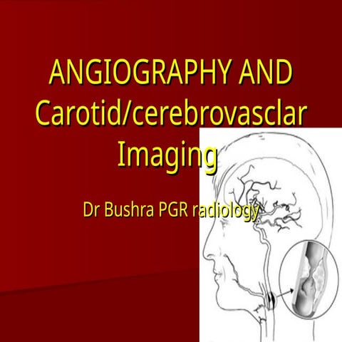 Presentation on cerbrovascular imaging.ppt