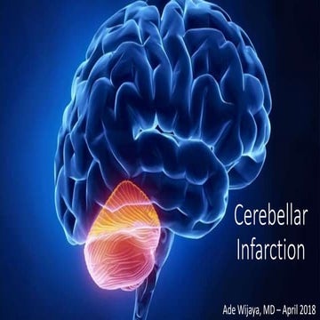 Cerebellar Infarction