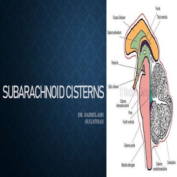 cerebral cisterns for radiology dnb .pptx