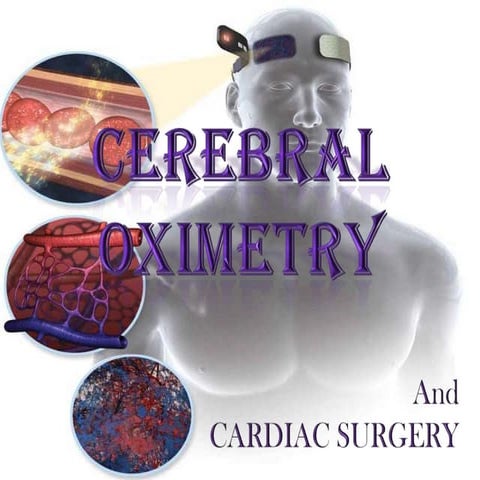 Cerebral oximetry