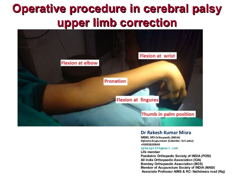 Cerebral palsy operative procedure in upper limb