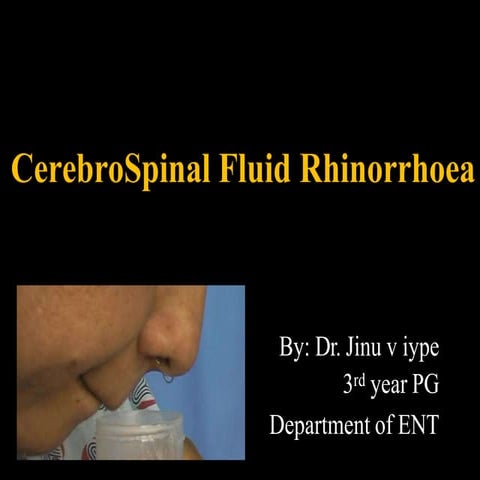cerebrospinalfluidrhinorrheajinu-200317192438.pptx