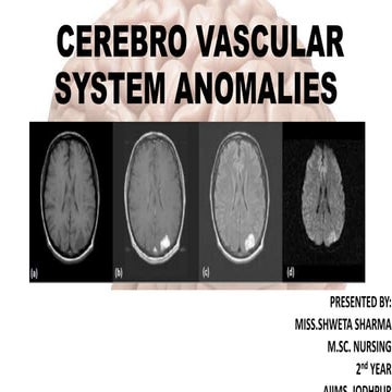 Cerebro vascular anomalies