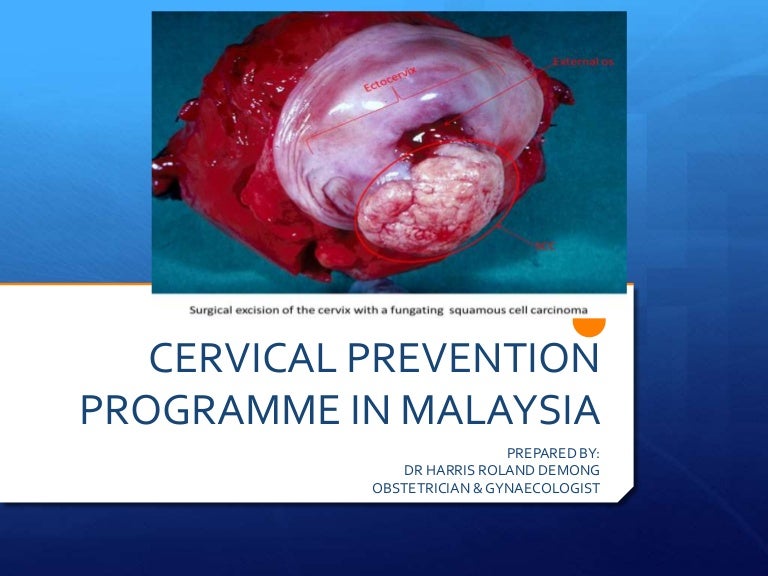Cervical Cancer In Malaysia / Cervical Cancer Screening