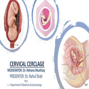 cervical cerclage.pptx
