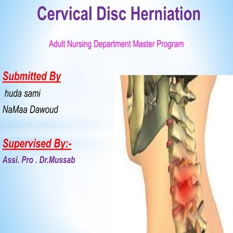 Cervical disc herination.pptx