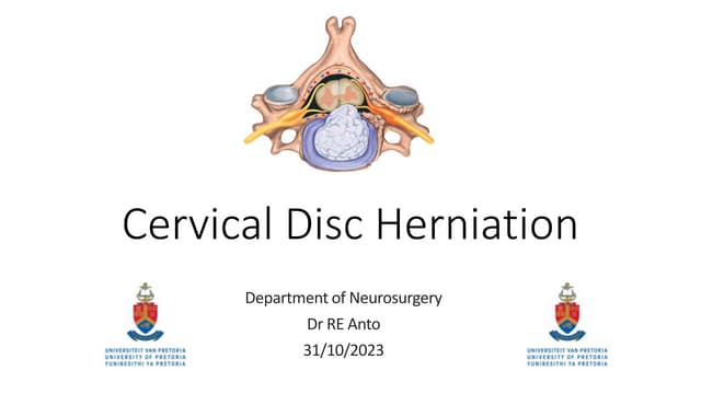 Overview of Cervical Disc Herniation.pptx
