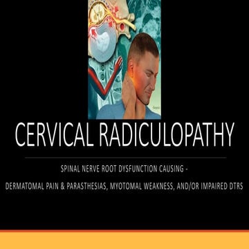 Cervical radiculopathy