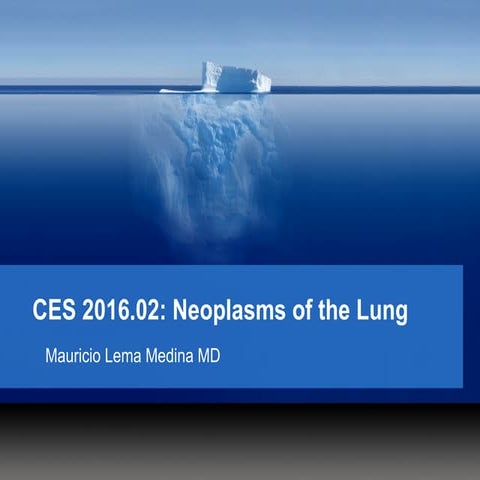 CES 2016 02 - Lung Cancer