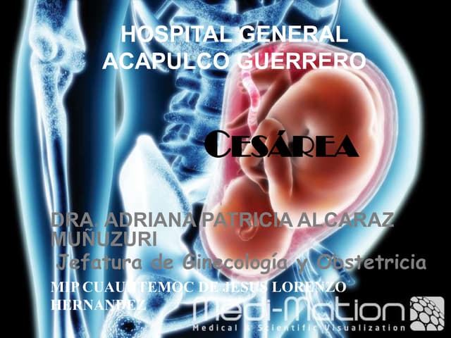 Cesara y tipos de cesareas indicaci...