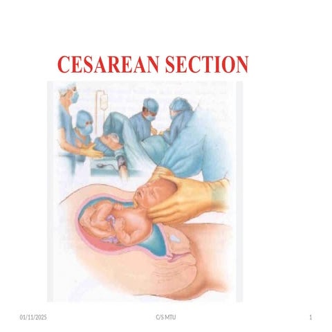 cesarean delivery  for midwifery students .pptx