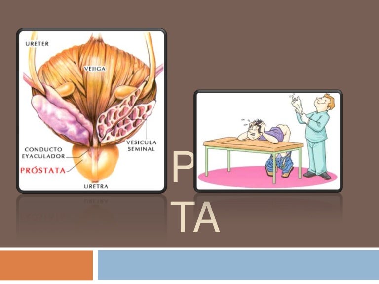 qué bacterias buscar en la prostatitis crónica ca qué bacterias buscar en la prostatitis crónica ca