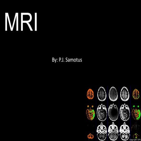 C:\Fakepath\Mri