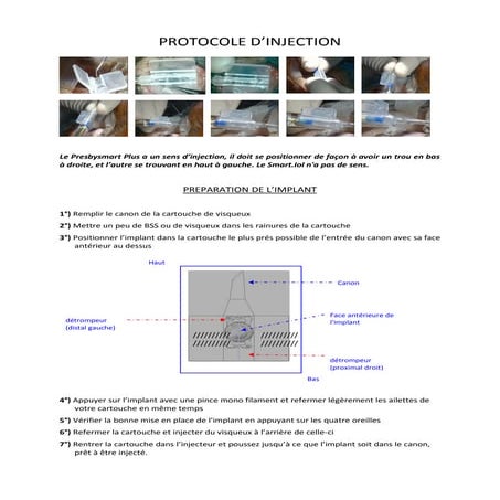 IOL Master | PDF