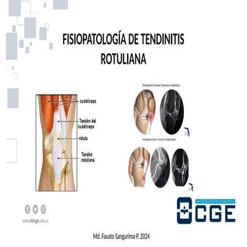CGE Fisiopatología de Tendinitis Rotuliana.pptx