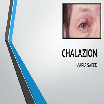 Chalazion