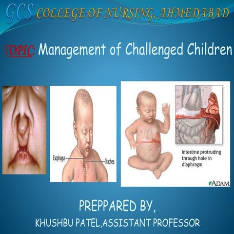 Challenged child management